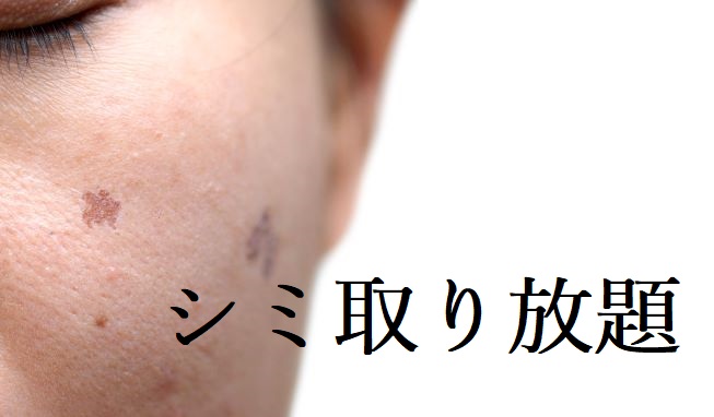 シミ取り放題 美しさを求めるすべての女性へ 北陸美容皮膚クリニック